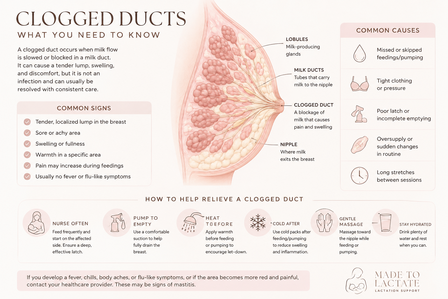 Clogged ducts infographic showing breast anatomy, common signs, common causes, and ways to help relieve a clogged duct